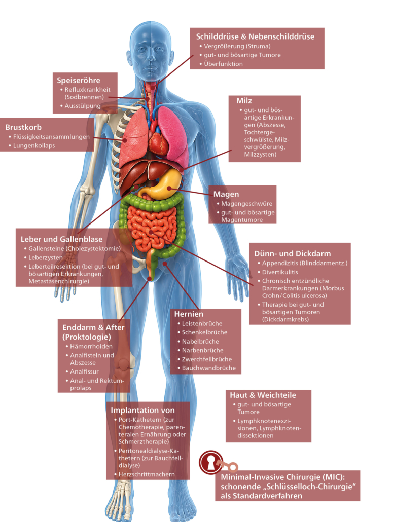 Schema Leistungsspektrum Allgemein- und Viszeralchirurgie